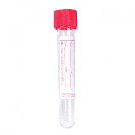 Primary Urine collection tube with Boric Acid 100x16mm - Global Scientific Ltd